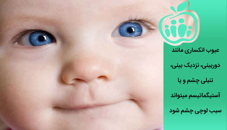 تاثیر عوامل انکساری بر انحراف چشم نوزادان