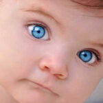 روشش های تشخیص و درمان انحراف چشم نوزادان