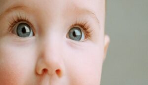 همه چیز درباره ی پف چشم نوزاد