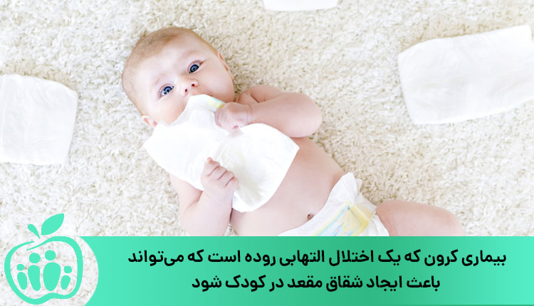 بیماری کرون و شقاق مقعد در نوزادان