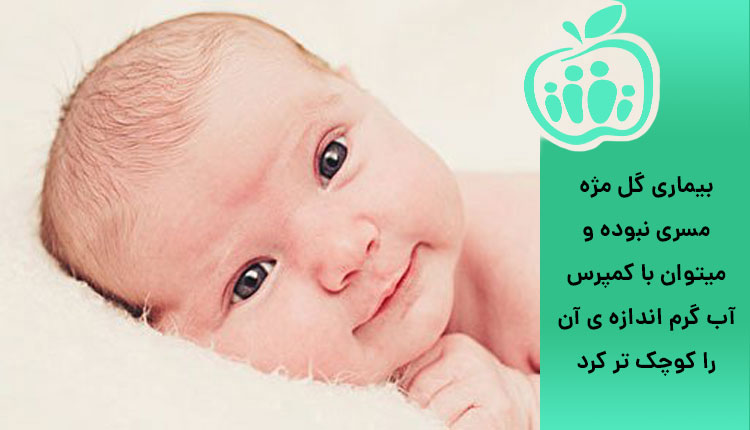 بیماری گل مژه و کاهش پف چشم نوزاد در نوزادان