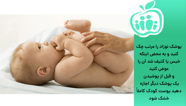 چک کردن پوشک نوزاد و جلوگیر از سوختگی پای نوزاد