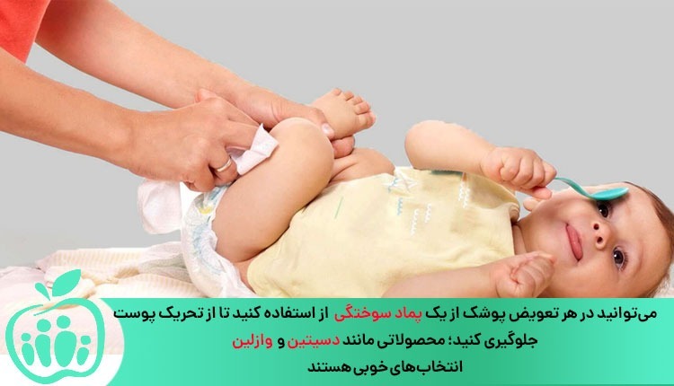 استفاده از پماد سوختگی در درمان سوختگی پای نوزاد