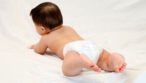 شقاق و زخم نوزادان