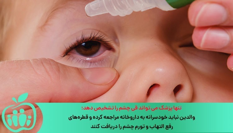 تشخیص قی چشم نوزاد توسط پزشک و منع استفاده خودسرانه قطره