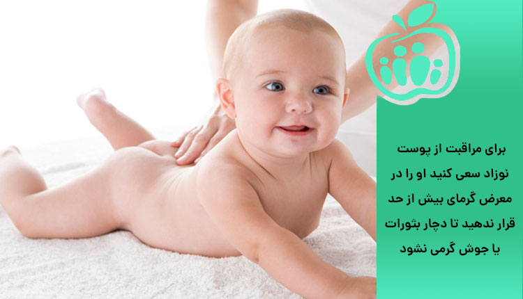 مراقبت از پوست نوزاد در برابر گرما