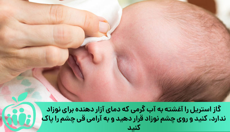 آموزش پاک کردن قی چشم نوزاد با گاز استریل