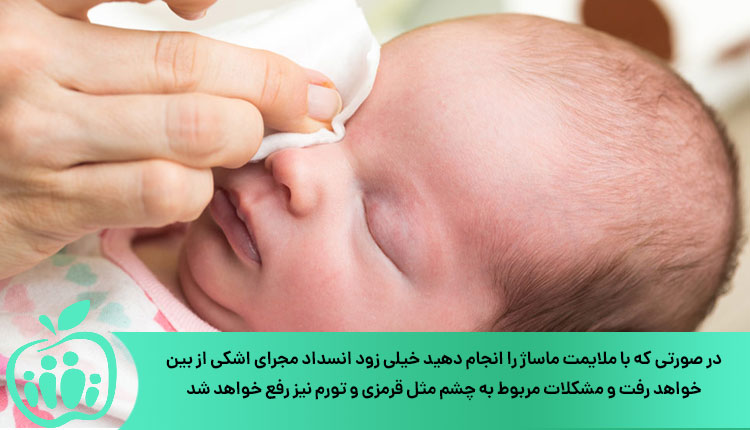 ماساژ و درمان انسداد مجرای اشکی در نوزادان