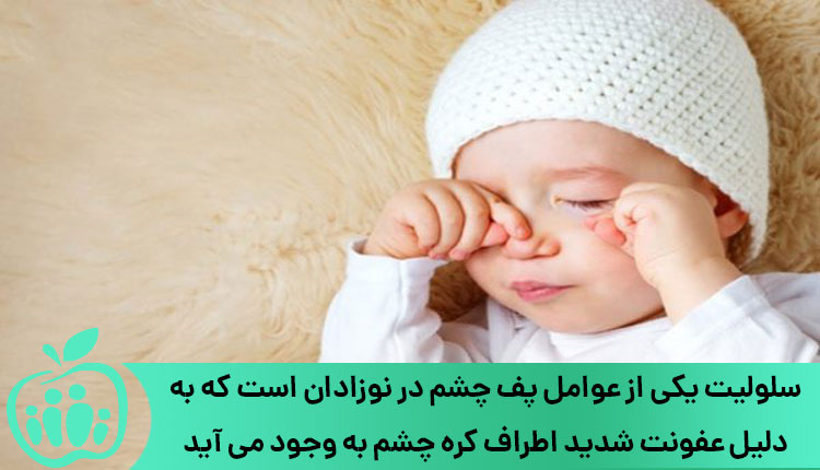 پف چشم نوزادان به علت سلولیت
