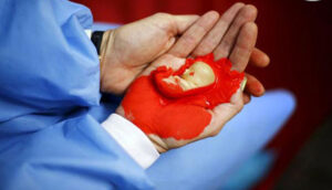 شاخص بارداری بعد از سقط