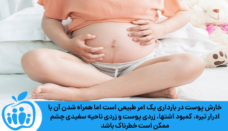 عوارض و خطرات احتمالی خارش پوست در دوران بارداری