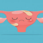 شاخص تنبلی رحم